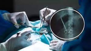 Forceps Left Inside Woman's Stomach