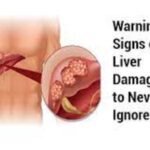 Warning Signs of Serious Liver Disease: Hair Loss and Beyond