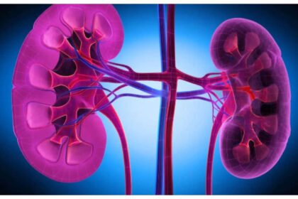 A fresh selection of cranberries, watermelon, garlic, turmeric, and apples for kidney detox